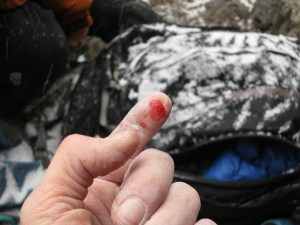 The glorious result of squeezing like hell on that left-hand crimp at the crux.